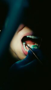 Tooth Sensitivity in North York: Why It Happens and How to Get Lasting Relief